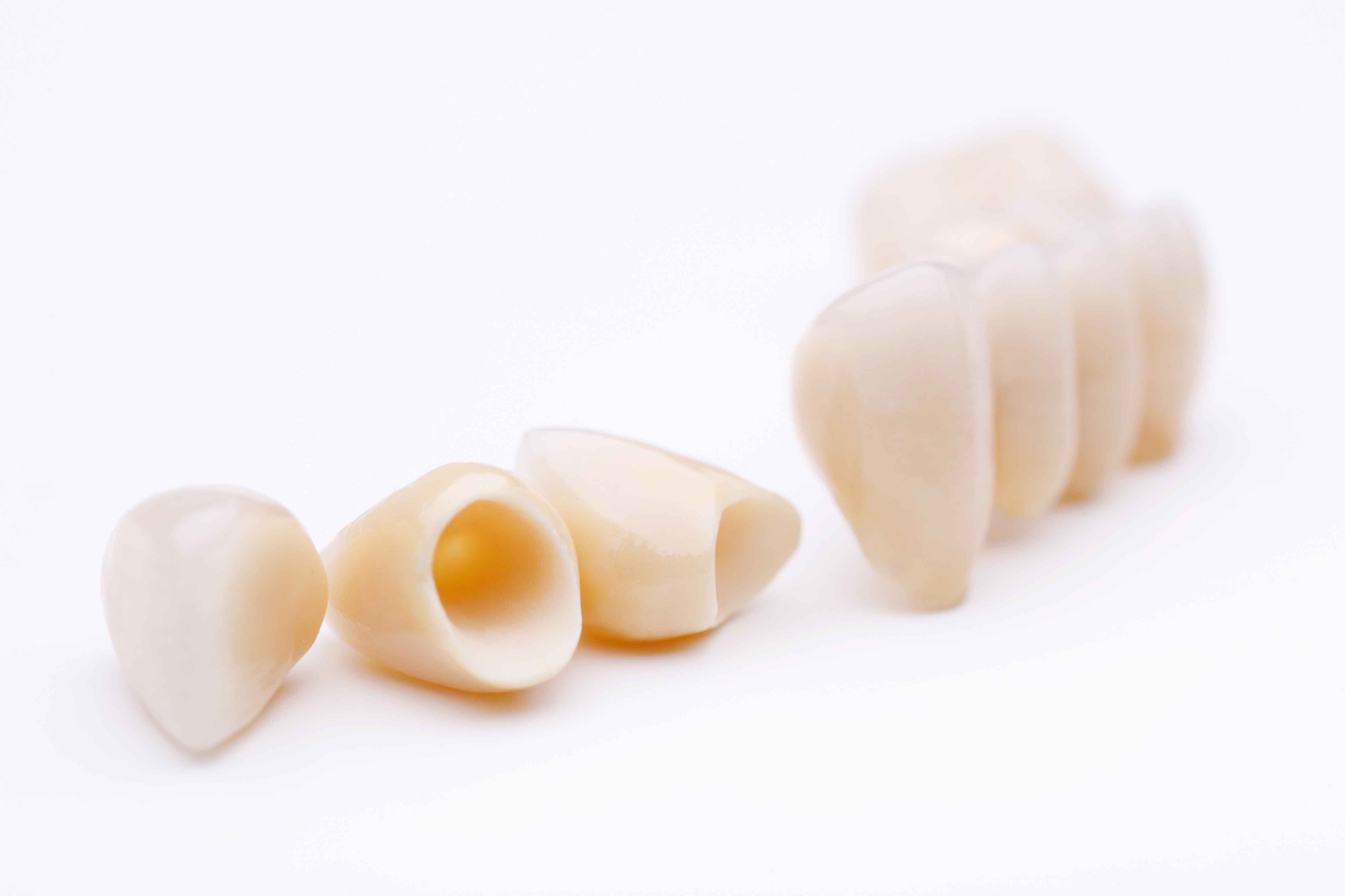 Prótesis dentales - Coronas