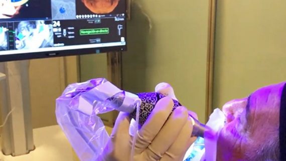 El cirujano se auto coloca un implante con cirugía navegada