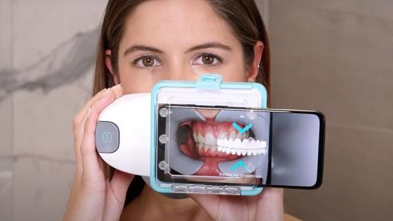 Ortodoncia Invisible y Dental Monitoring