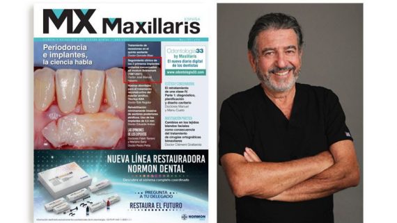 Seguimiento clínico de los 2 primeros implantes unitarios que fueron colocados en España por el Dr. José Manuel Navarro (1987-2021)