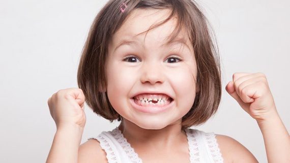 Soluciones para los dientes torcidos en niños