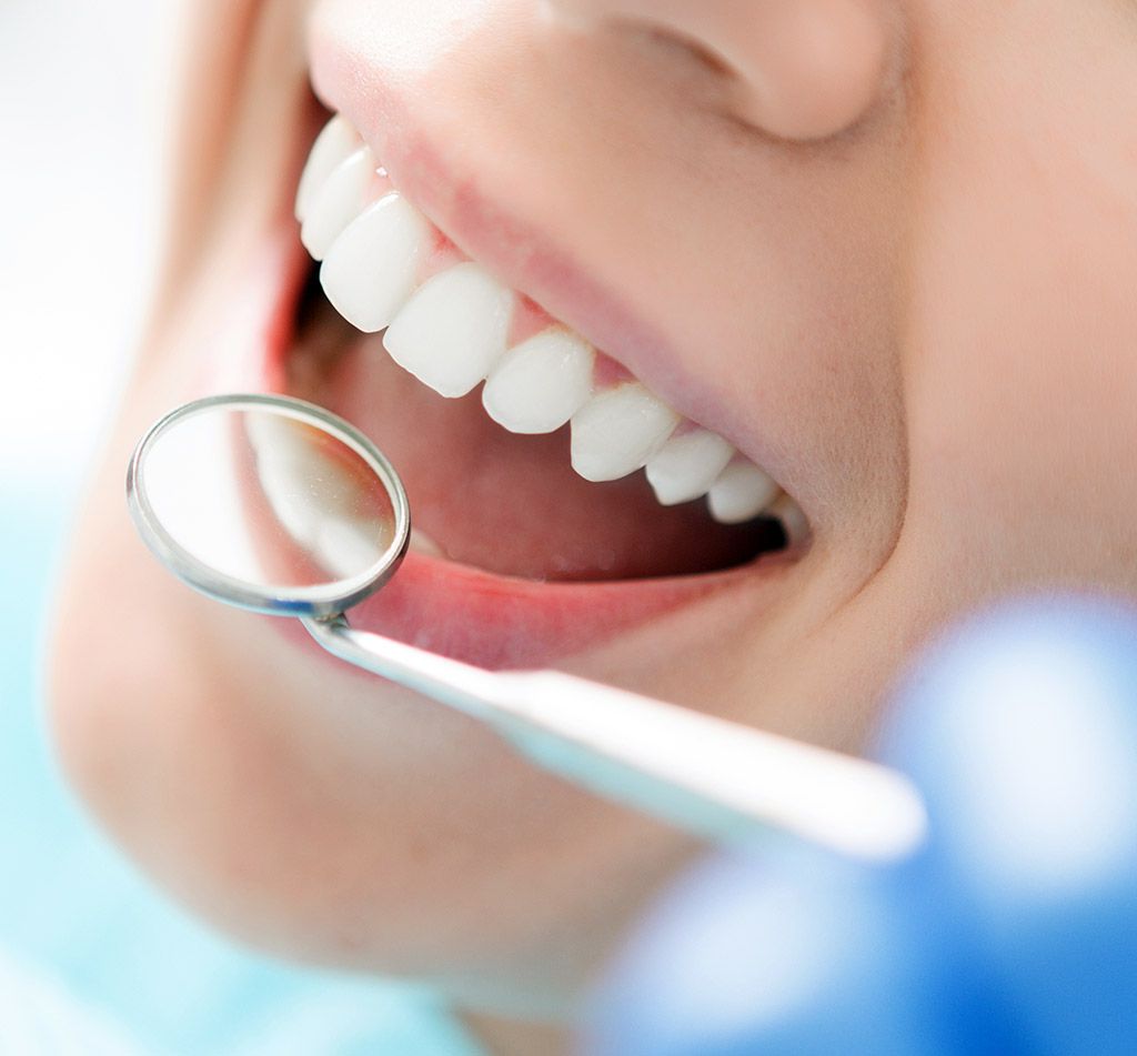 Tratamientos de odontología preventiva