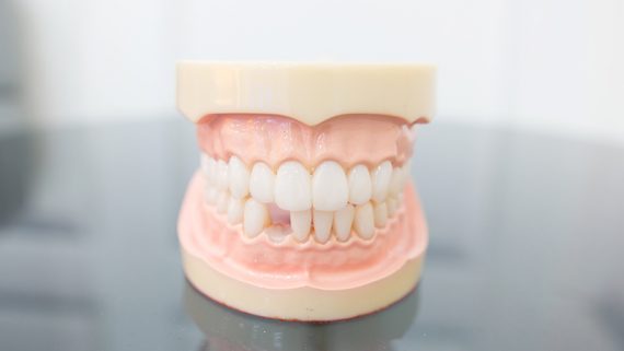 ¿Se pueden poner dientes sin implantes?