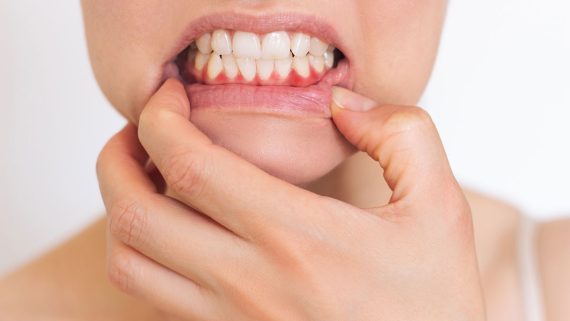 Tengo un bulto en la encía, ¿qué hago?