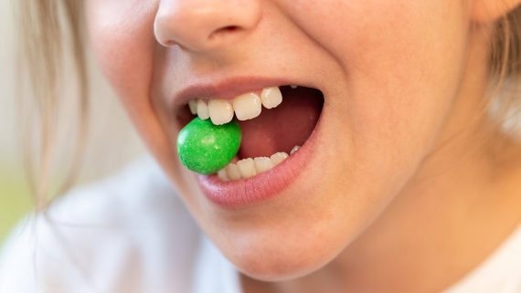 ¿Hay alimentos malos para los dientes?